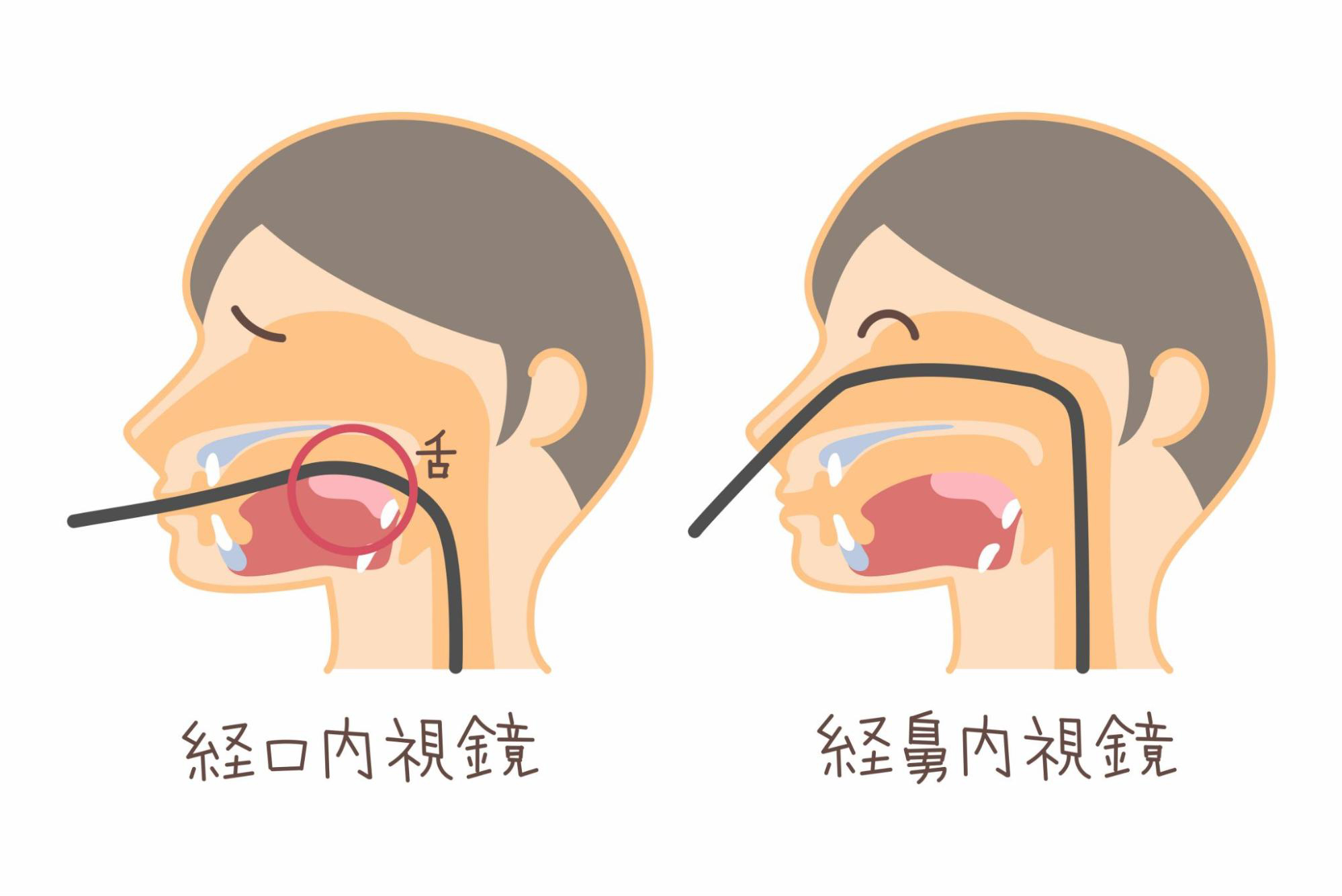 胃カメラ検査とは？どんな検査？